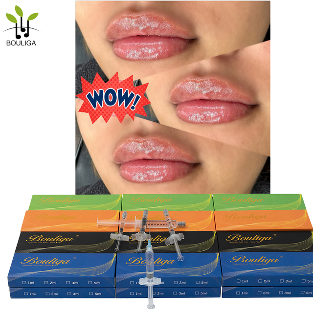 Bouliga Dermal filler 2ml 100% axit hyaluronci nồng độ 20mg / ml cho Lip Glow Up
